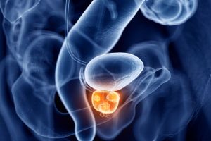 Pelvic Ultrasound (Men)/Prostate & Bladder
