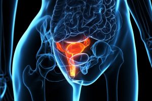 Pelvic Ultrasound (women)/Uterus and Ovaries