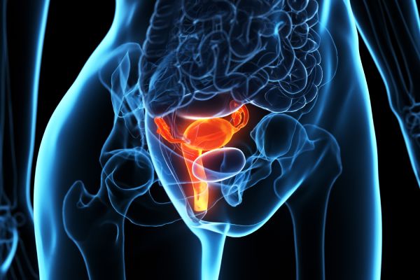 Pelvic Ultrasound (women)/Uterus and Ovaries