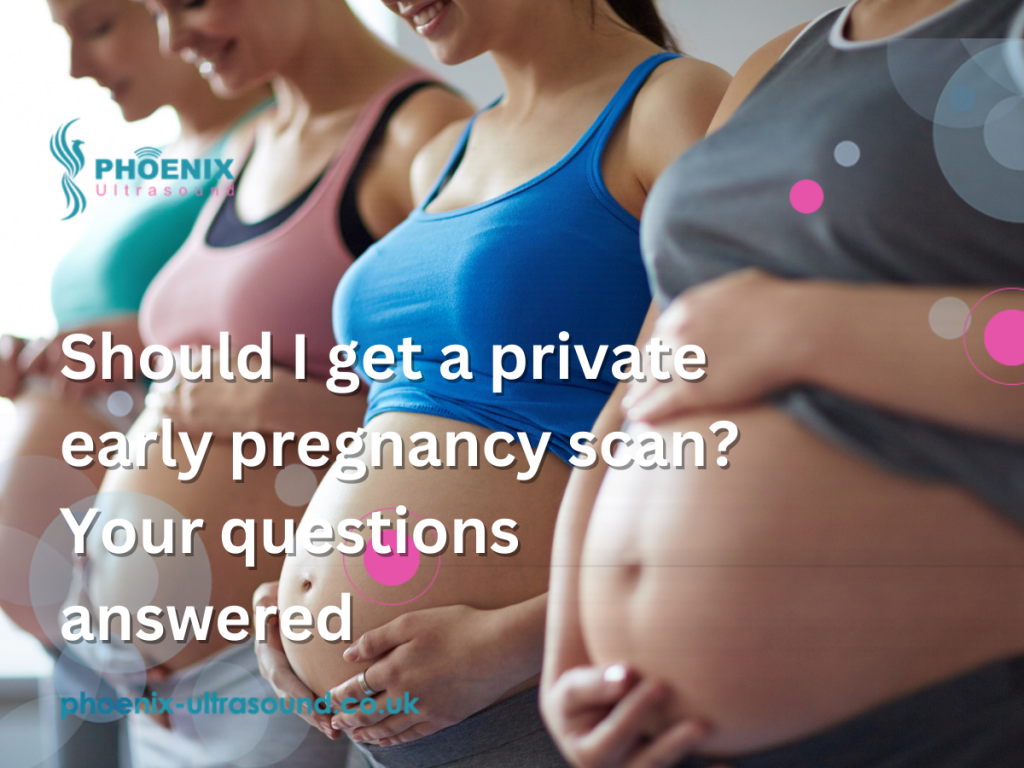 Should I get a private early pregnancy scan? Your questions answered