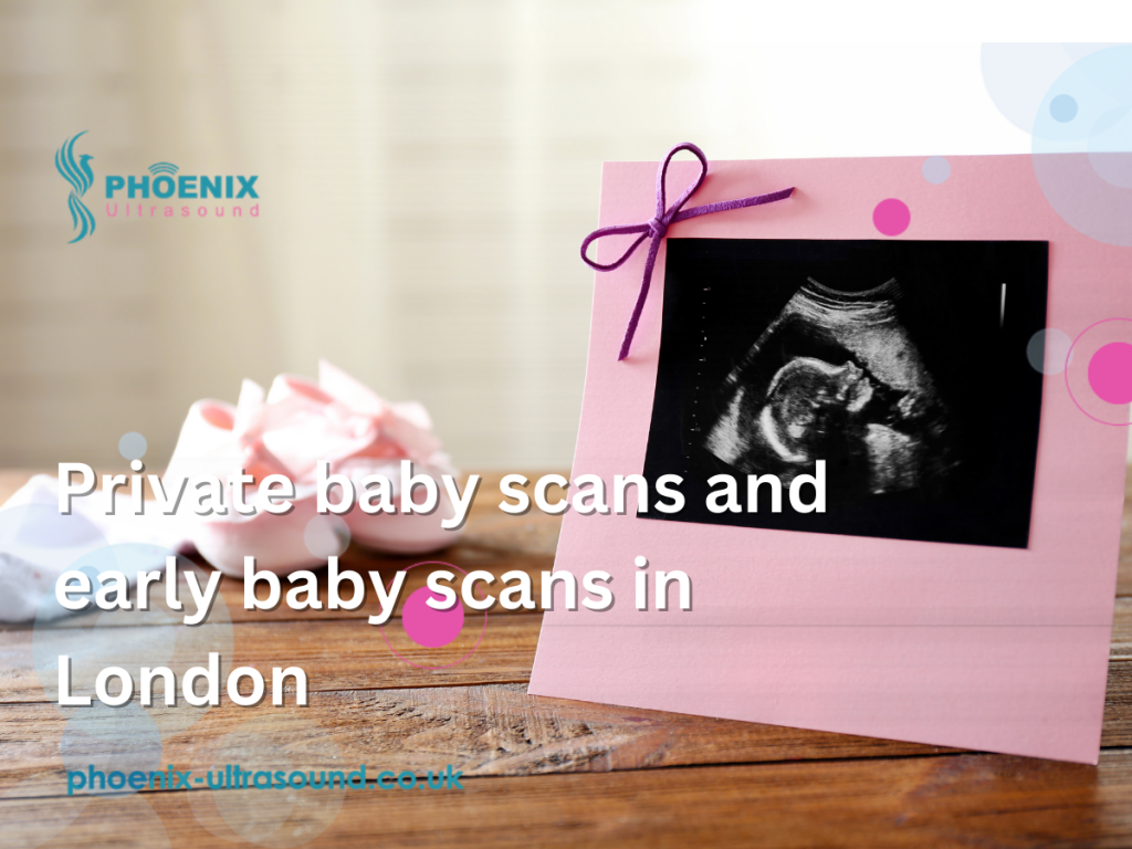 Private baby scans and early baby scans in London