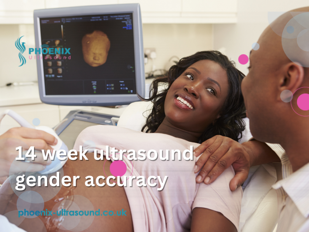 14 week ultrasound gender accuracy