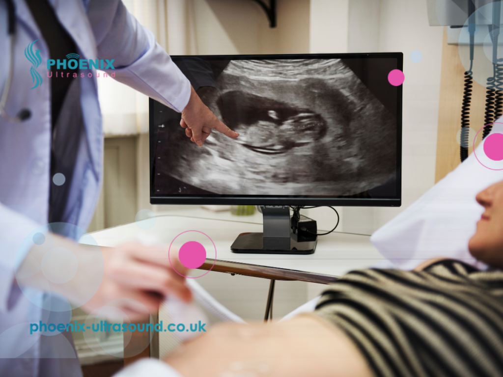 The benefits of ultrasound in early pregnancy scan