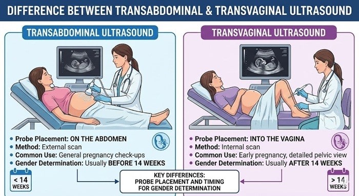 14 week ultrasound gender accuracy 4 the Difference Between a Transabdominal and Transvaginal Ultrasound
