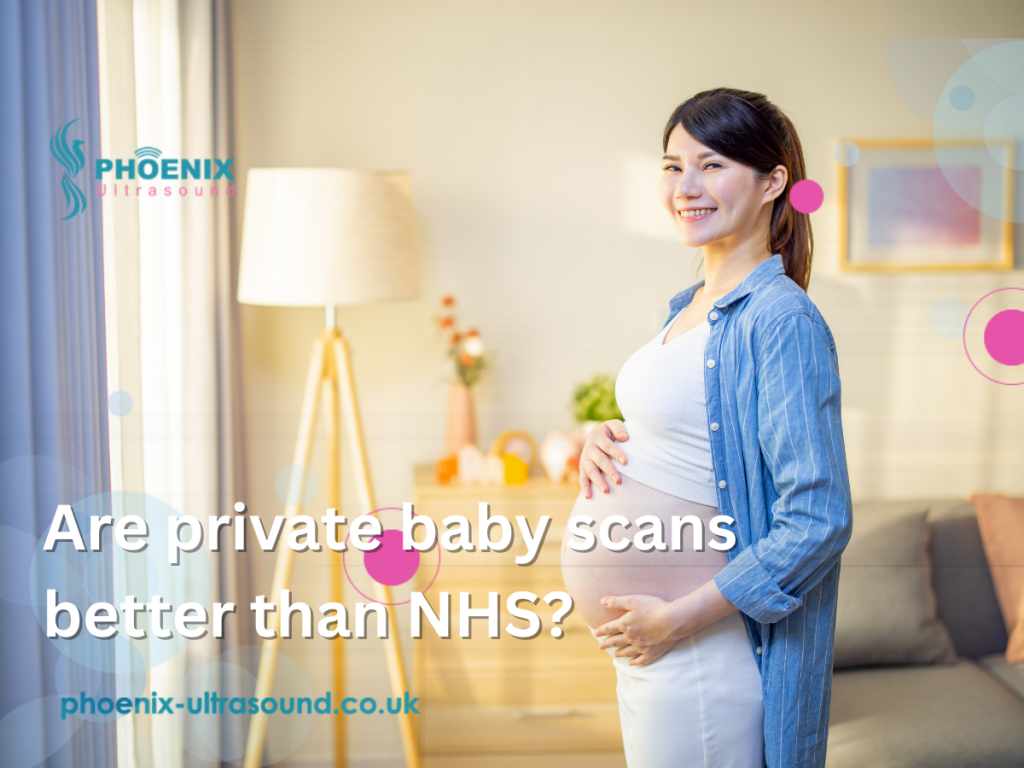 Are private baby scans better than NHS?