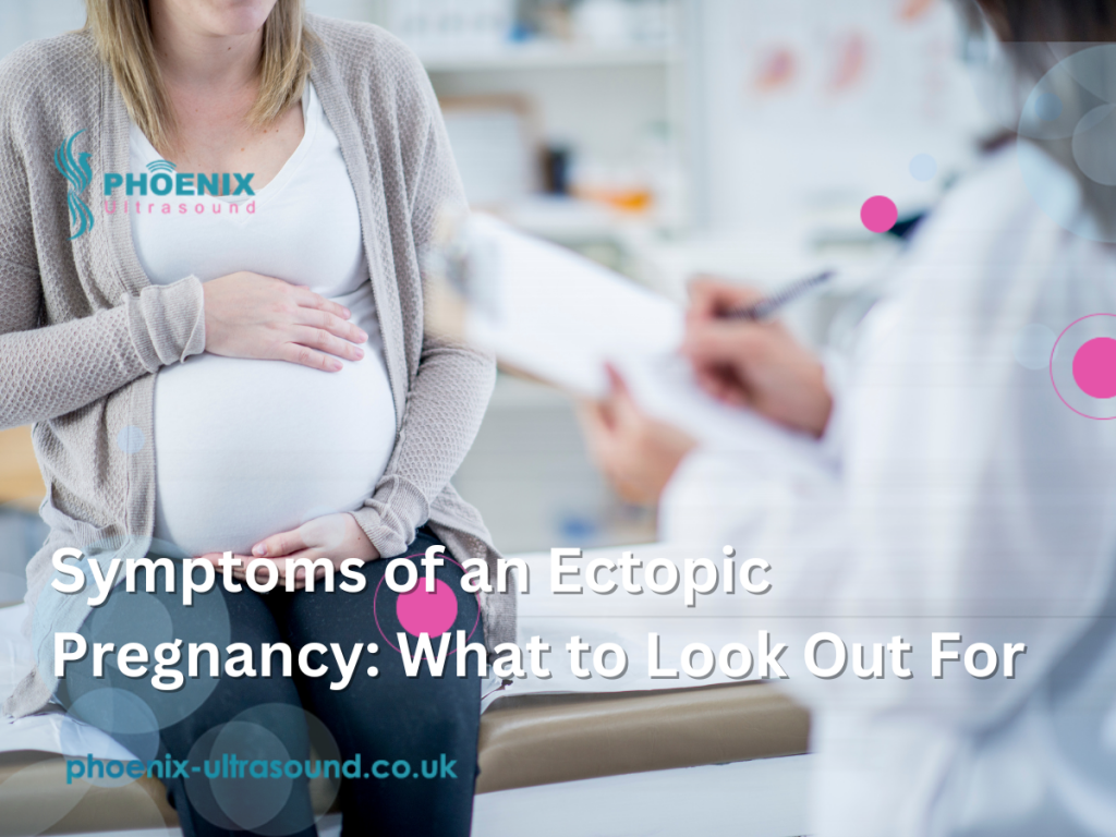 Symptoms of an Ectopic Pregnancy: What to Look Out For