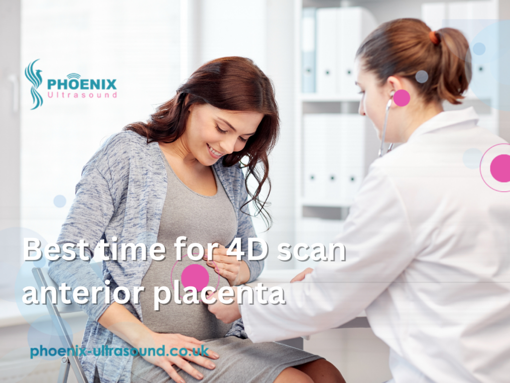 Best time for 4D scan anterior placenta