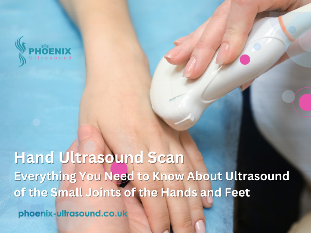 Hand Ultrasound Scan: Everything You Need to Know About Ultrasound of the Small Joints of the Hands and Feet