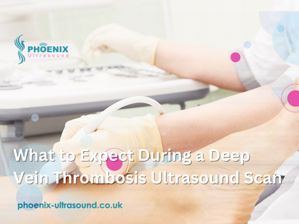 What to Expect During a Deep Vein Thrombosis Ultrasound Scan 