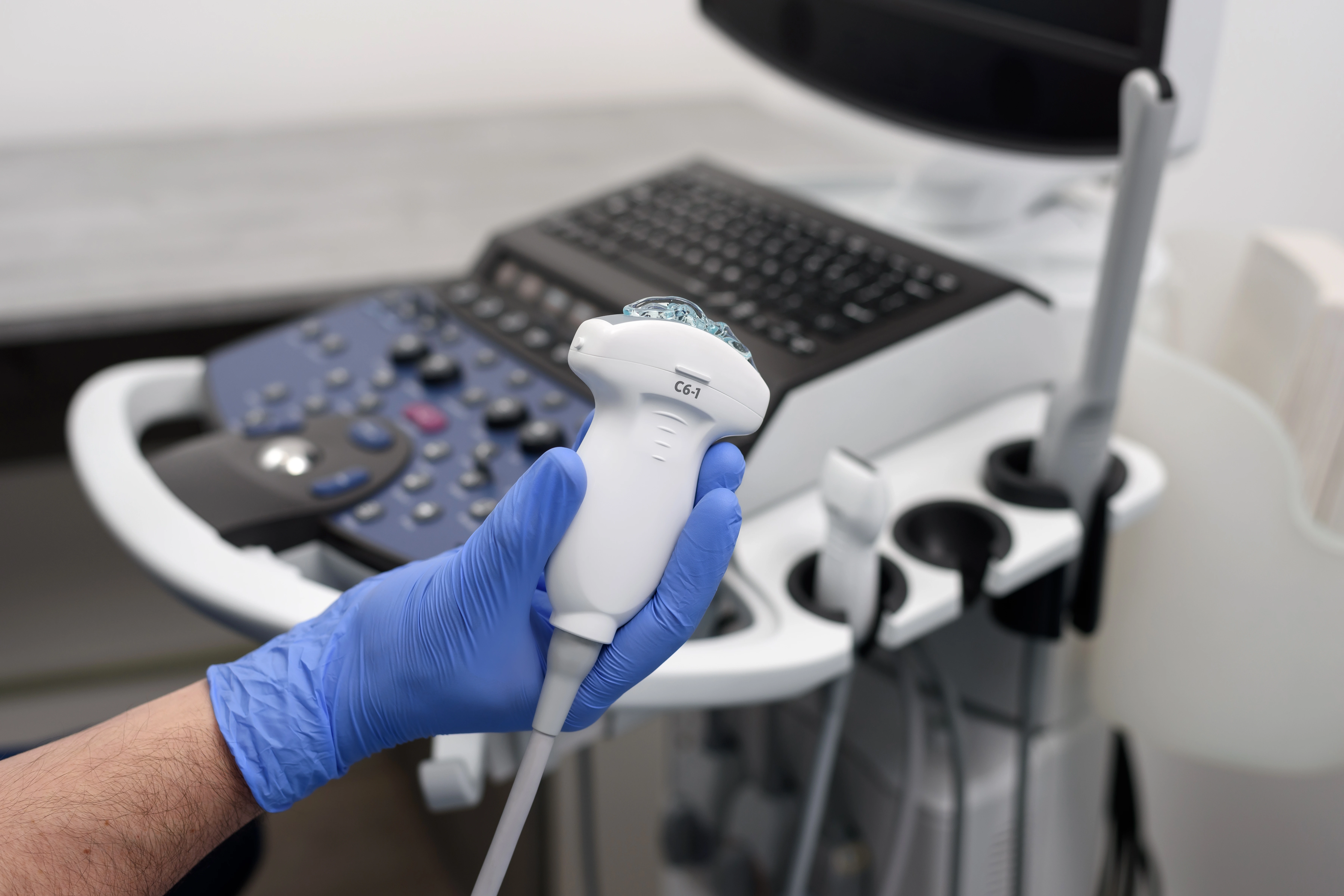 A sonographer performing a penile Doppler ultrasound