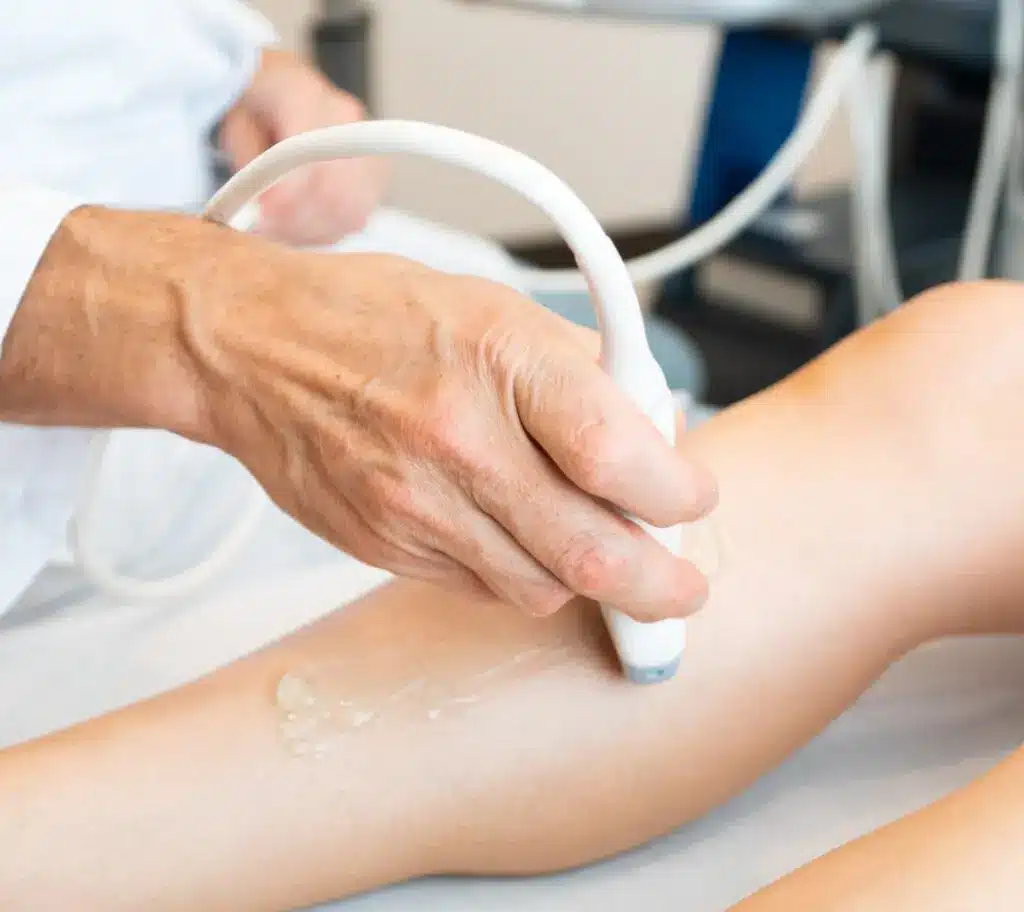 Varicose Vein/Venous Insufficiency